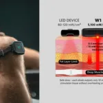 MATELASER’s W1 REGEN wearable laser therapy device delivers 5,100 mW/cm² through dual-wavelength