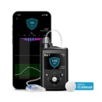 The MiniMed 780G system integrated with Abbott’s Instinct sensor marks a new direction in CGM-insulin pump pairings.