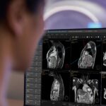 Philips showcases its next-generation AI-powered cardiac MR innovations at RSNA 2025, aimed at improving speed, diagnostic precision, and patient access.