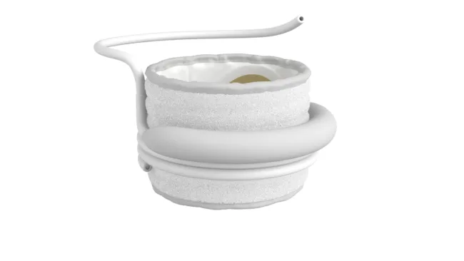 Edwards Lifesciences’ SAPIEN M3 is the first transseptal transcatheter mitral valve replacement system to receive U.S. Food and Drug Administration approval.