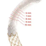 Gore’s new VIATORR device offers size flexibility in portal shunt treatment
