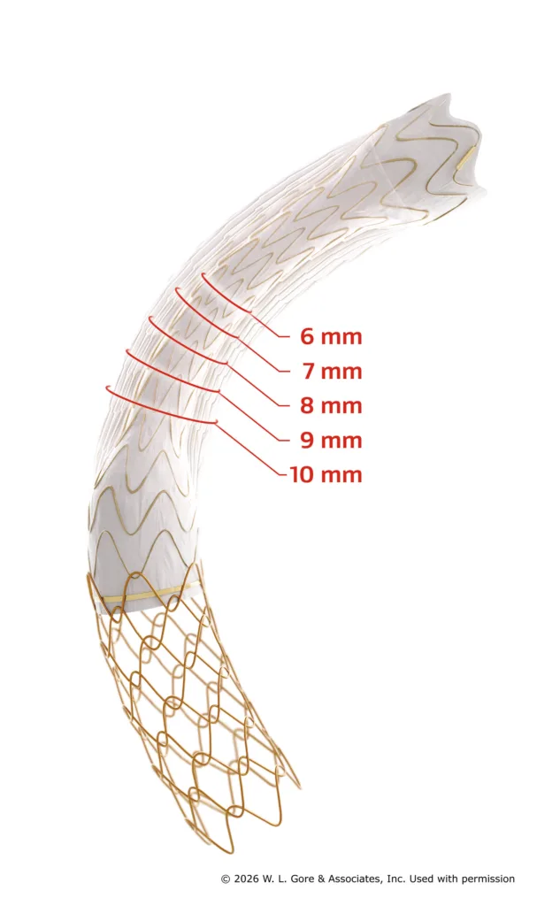 Gore’s new VIATORR device offers size flexibility in portal shunt treatment
