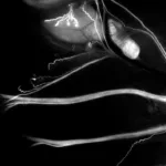 Trace Biosciences moves toward first-in-human trials with breakthrough nerve imaging agent