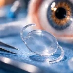 TECNIS PureSee approval highlights how cataract surgery is increasingly becoming a refractive vision procedure