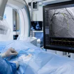 Representative image of an AI-guided coronary imaging system in a modern cardiac catheterization lab, illustrating how Abbott’s Ultreon 3.0 clearance could push precision PCI, stent planning, and real-time artery analysis deeper into routine cardiovascular care.