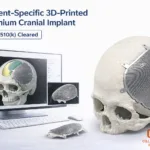 CGBIO’s EASYMADE TI wins FDA clearance as customized cranial reconstruction gains momentum