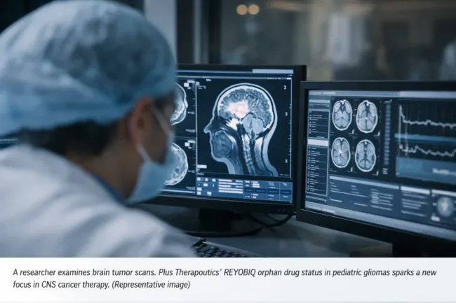 Plus Therapeutics REYOBIQ orphan drug designation in pediatric malignant gliomas highlights growing interest in targeted CNS cancer therapies for rare childhood brain tumors. Representative image.