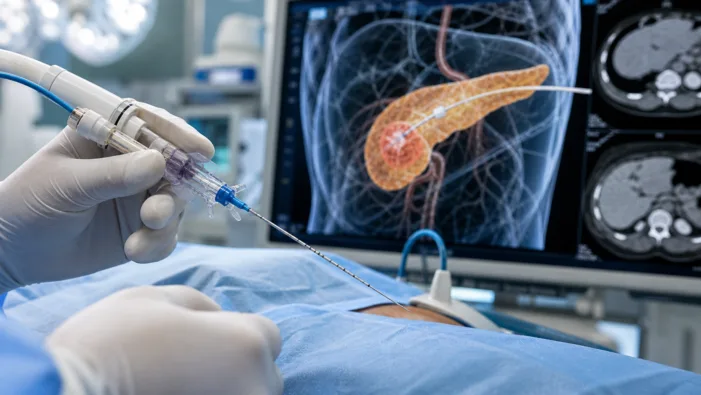 Can Vector Science’s microneedle catheter patent crack one of oncology’s hardest delivery problems?