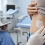 Representative image of a weekly contraceptive patch being assessed in a clinical setting, reflecting Viatris Inc.’s MR-100A-01 data update as the FDA review places low-dose estrogen transdermal contraception back in focus.
