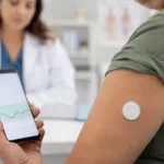 Representative image: A continuous glucose monitoring sensor and smartphone glucose trend display illustrate how Dexcom G7 could expand CGM use for adults with type 2 diabetes not using insulin after the CONNECT study.