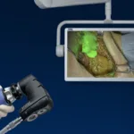 FDA clearance for Rubina Lens gives KARL STORZ a sharper open surgery proposition