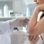 Representative image: A dermatologist examines an eczema flare, reflecting how EBGLYSS and other atopic dermatitis biologics are shifting the treatment conversation toward fewer injections, longer disease control, and lower patient burden.