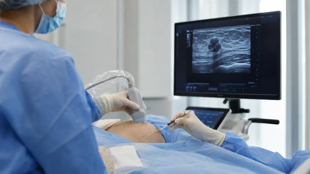 A clinician performs an ultrasound-guided breast cryoablation procedure as IceCure Medical expands ProSense installations for minimally invasive treatment of selected low-risk breast cancer patients. Representative image.