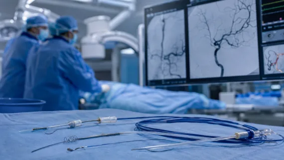 Why Medtronic’s Scientia Vascular acquisition matters for stroke device workflows