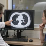 Representative image: Clinicians review a chest CT scan as AI-assisted lung nodule risk assessment gains attention through Tanner Health’s Optellum rollout, highlighting the push to improve early lung cancer triage in regional care.