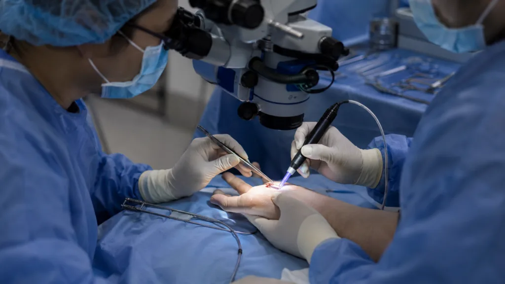 Representative image of surgeons using a light-activated device during peripheral nerve repair as Tissium advances Coaptium Connect in the race to reduce reliance on traditional microsutures.