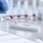 Representative image: A generic diagnostic test setup illustrates how blood-based lateral flow testing could support Ebola triage and treatment monitoring as VolitionRx advances patent protection for its Nu.Q NETs platform.