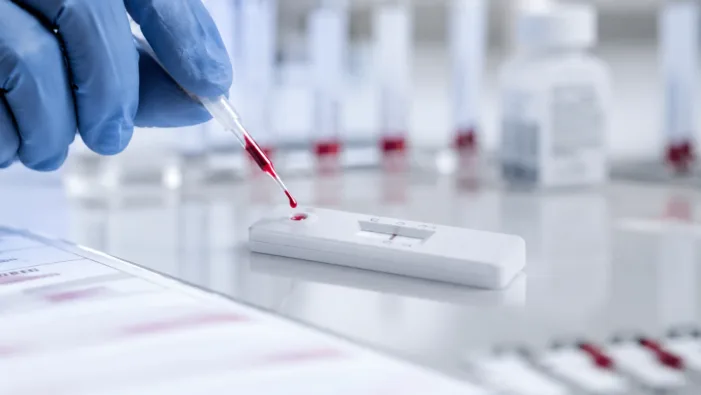 Representative image: A generic diagnostic test setup illustrates how blood-based lateral flow testing could support Ebola triage and treatment monitoring as VolitionRx advances patent protection for its Nu.Q NETs platform. Why VolitionRx is positioning Nu.Q NETs beyond sepsis and into Ebola monitoring