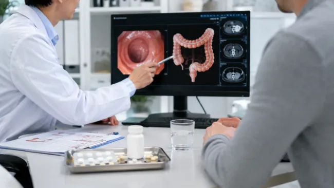 A gastroenterologist reviews inflammatory bowel disease imaging and oral treatment options as cAMPfield Therapeutics advances prifemilast for ulcerative colitis and Crohn’s disease. Representative image.