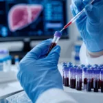 Representative image: Laboratory researchers handle blood samples during chronic hepatitis B drug development, reflecting Brii Bio’s Phase 2b ENRICH and ENHANCE results for BRII-179, elebsiran and pegylated interferon alfa.