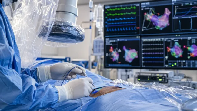 Representative image: Electrophysiology procedure scene illustrating how Johnson & Johnson’s FDA-approved Dual Energy Thermocool Smarttouch SF Platform could advance atrial fibrillation ablation with radiofrequency and pulsed field energy.