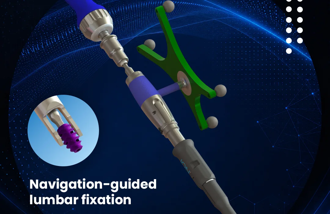 FDA clearance connects SurGenTec ION-L with Medtronic StealthStation workflow