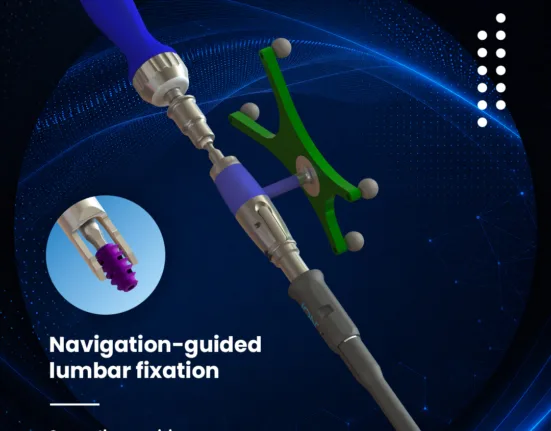 FDA clearance connects SurGenTec ION-L with Medtronic StealthStation workflow