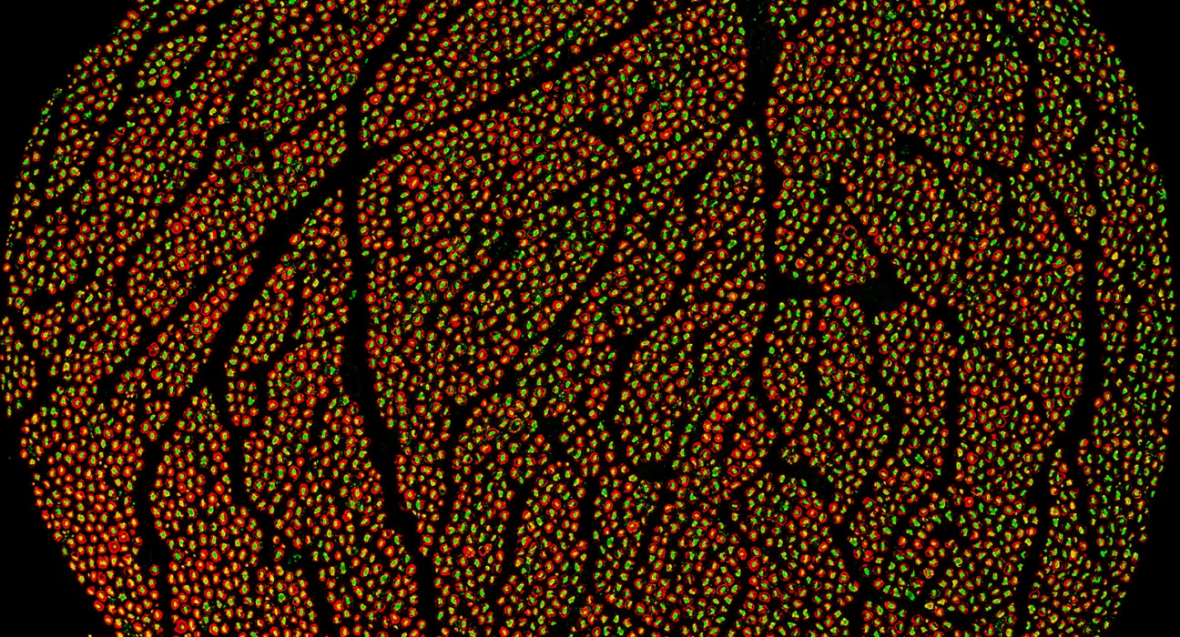 Feinstein Institutes releases comprehensive human vagus nerve map to advance precision neuromodulation