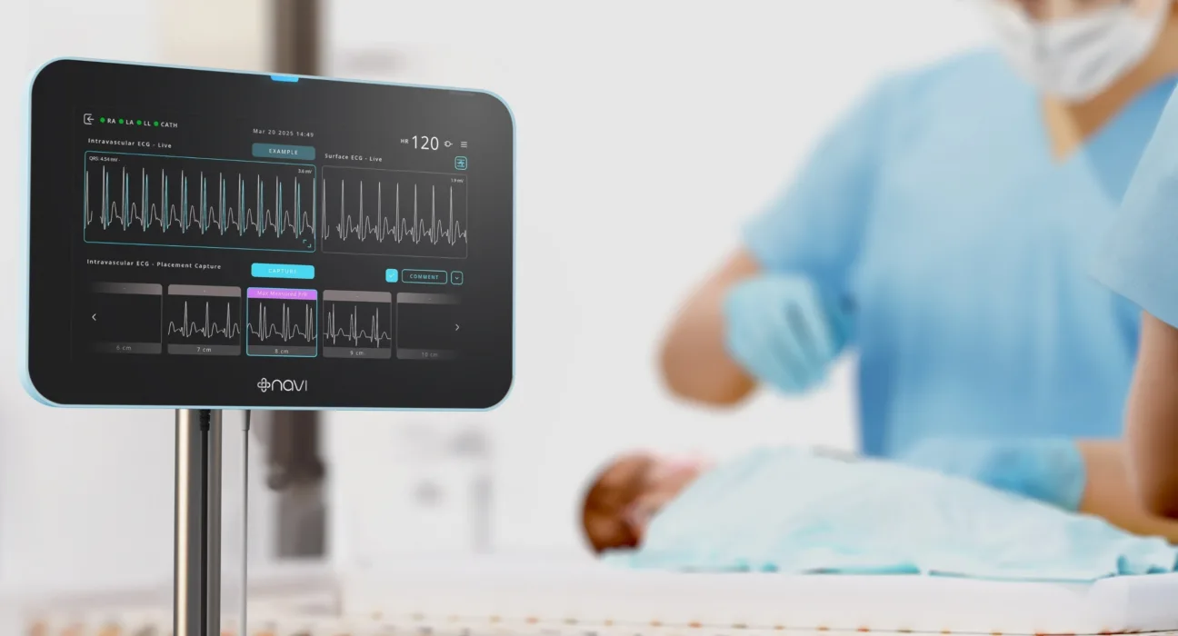 Navi Medical Technologies funds U.S. rollout of paediatric ECG tip location system