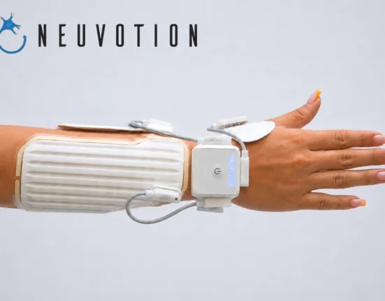 Neuvotion targets stroke and spinal cord injury rehabilitation with NeuStim commercial launch