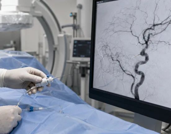 A steerable neurovascular guidewire is illustrated during a stroke intervention, reflecting Rapid Medical’s DRIVEWIRE 35 FDA clearance and its potential to simplify catheter access. Representative image.