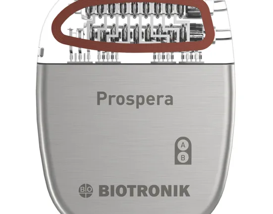 BIOTRONIK Neuro combines daily remote monitoring and AI in Prospera SCS platform