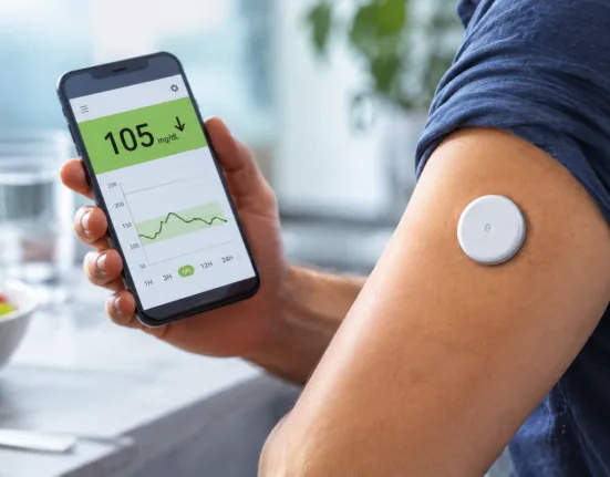 FDA-cleared over-the-counter continuous glucose sensors are expanding glucose monitoring beyond insulin users, but evidence for meaningful weight loss or broad metabolic benefits in people without diabetes remains limited. Representative image.