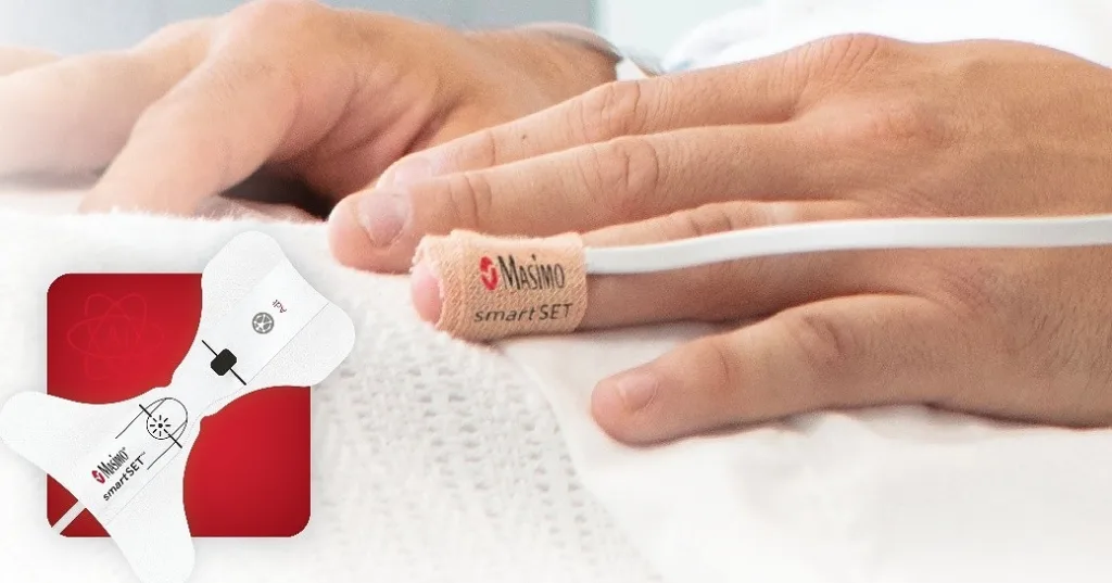 Masimo smartSET receives FDA clearance for atrial fibrillation detection