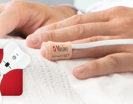 Masimo smartSET receives FDA clearance for atrial fibrillation detection