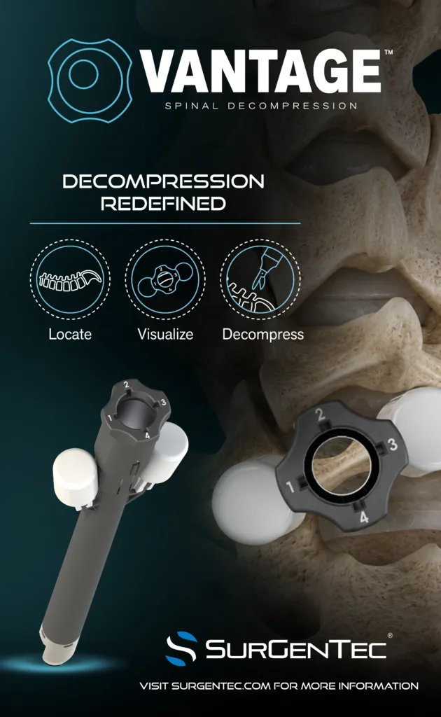 SurGenTec expands minimally invasive spine surgery portfolio with disposable Vantage system